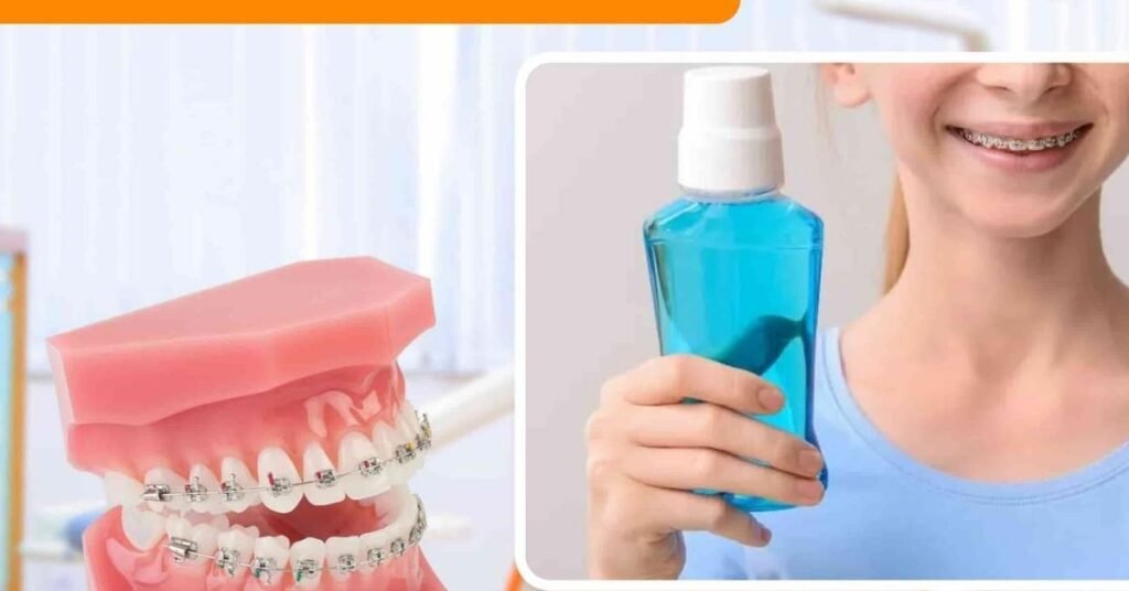 Nước Súc Miệng tại Nha Khoa Dr. Tường Smile