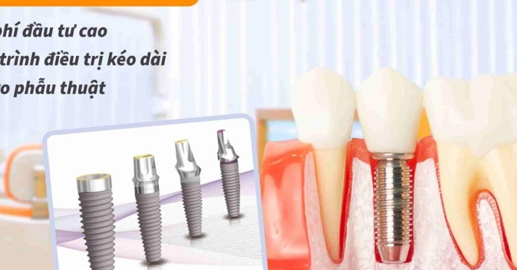 Cấy Ghép Implant Cho Người Cao Tuổi tại Nha Khoa Dr. Tường Smile