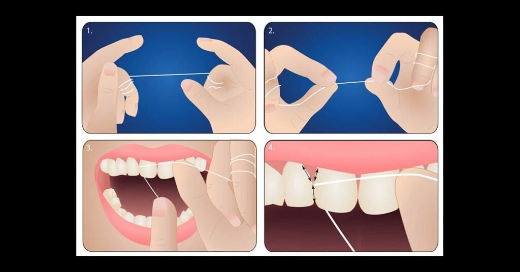 Hướng Dẫn Sử Dụng Chỉ Tơ Nha Khoa Đúng Chuẩn tại Nha Khoa Dr. Tường Smile