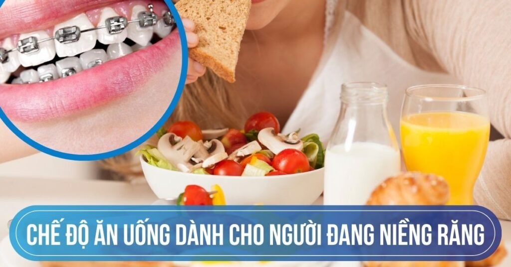 Chế Độ Ăn Uống Khi Đang Niềng Răng tại Nha Khoa Dr. Tường Smile