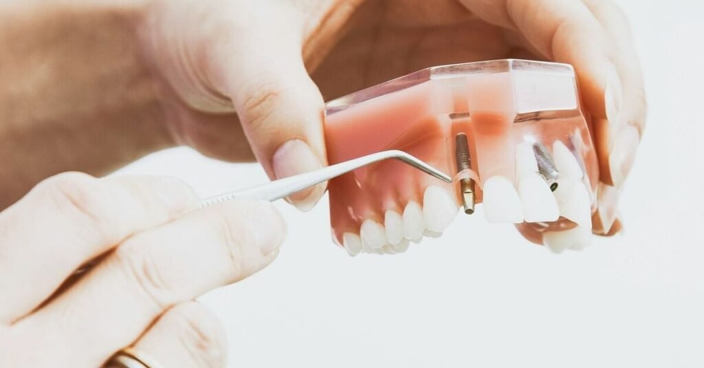 Trồng Implant Khi Hút Thuốc tại Nha Khoa Dr. Tường Smile