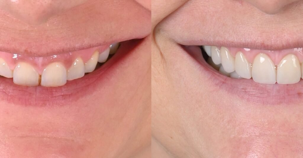 Những Yếu Tố Quyết Định Thành Công Của Nha Khoa Thẩm Mỹ tại Nha Khoa Dr. Tường Smile