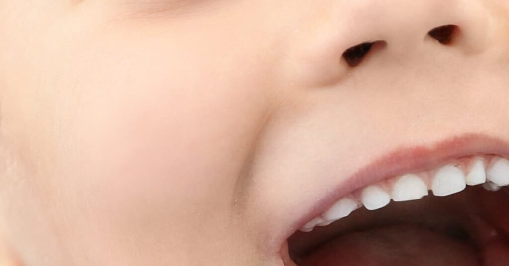 Giữ Khoảng Răng Sữa tại Nha Khoa Dr. Tường Smile