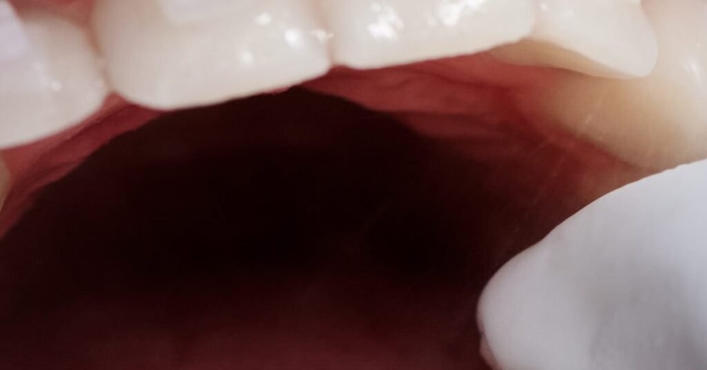 Đau Răng Khi Nhai tại Nha Khoa Dr. Tường Smile
