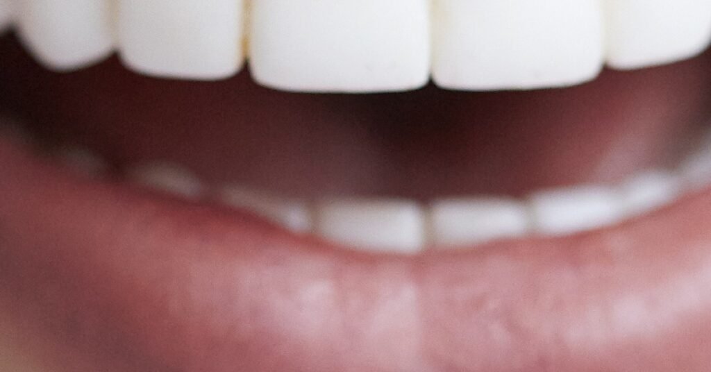 Bí Quyết Để Veneer Sứ Trông Tự Nhiên Như Răng Thật tại Nha Khoa Dr. Tường Smile