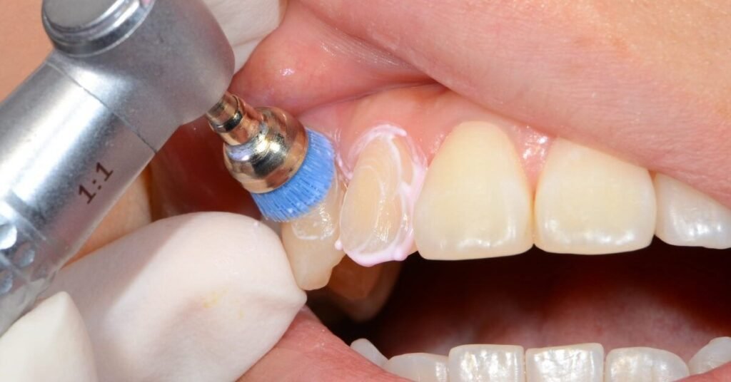 Xử Lý Đau Răng Tại Nhà Trước Khi Đến Nha Khoa tại Nha Khoa Dr. Tường Smile