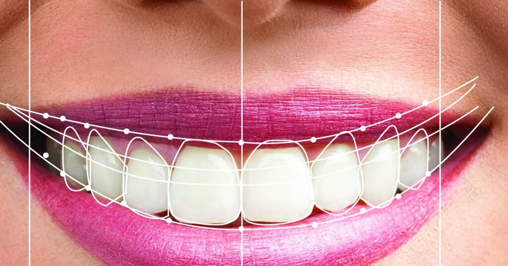 Thiết Kế Nụ Cười tại Nha Khoa Dr. Tường Smile